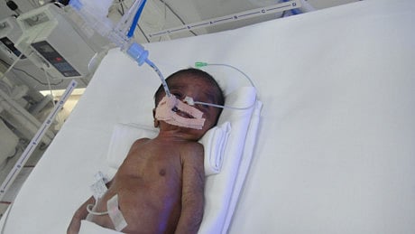 1.1540440-3883519870