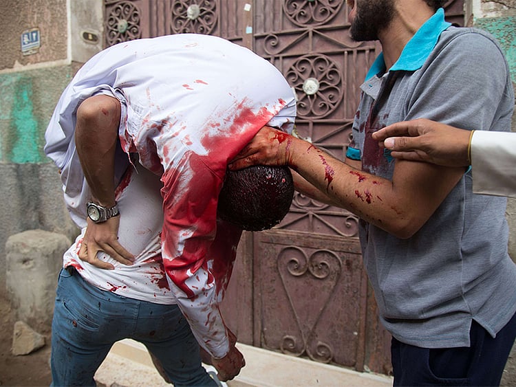 1.1551742-2904013863