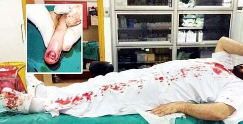 Doctor, nurse attacked in Kuwait hospital
