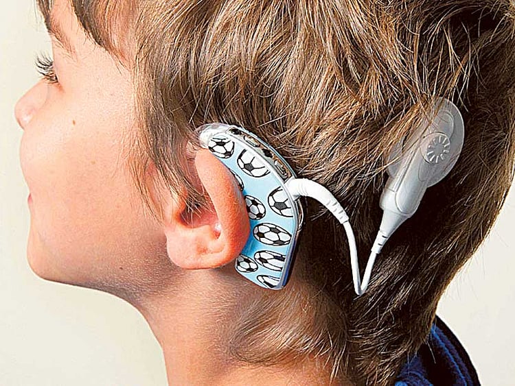 1.1695176-3010491319