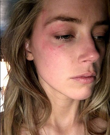 1.1836777-3190286494