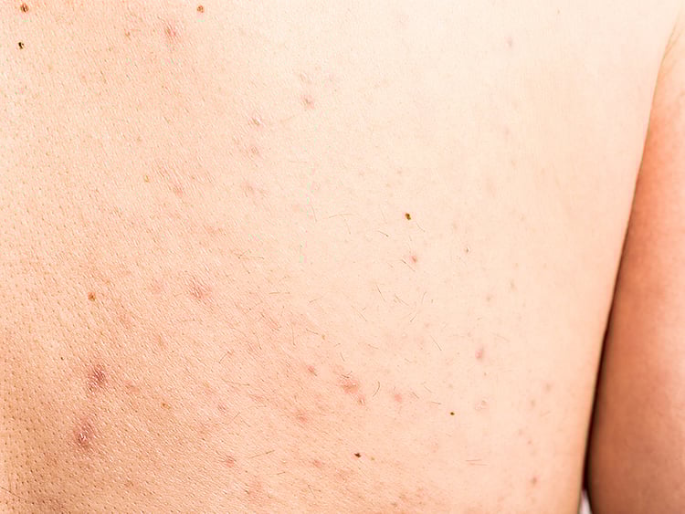 1.1879284-2976373283