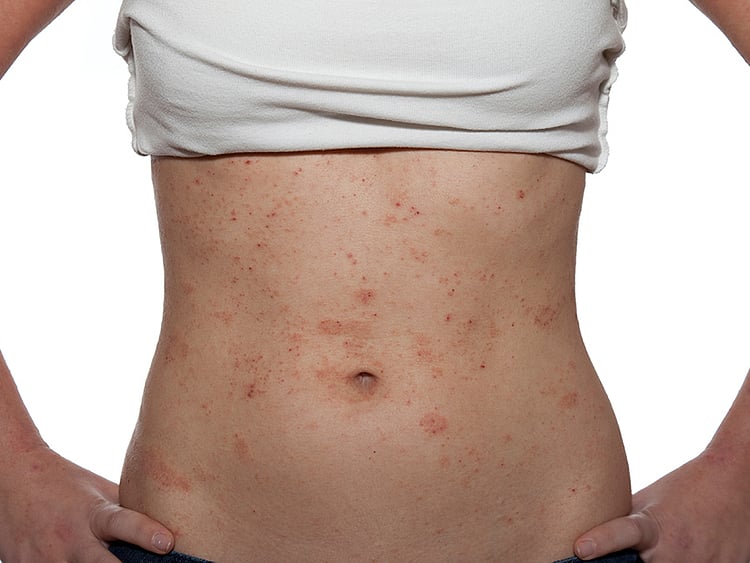 1.1880713-4220945582