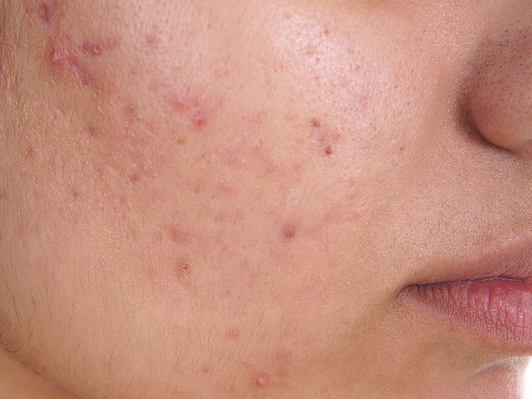 1.1880651-1823378816