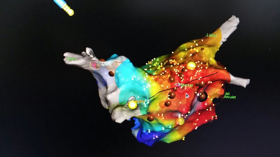 1.1895426-1117430754