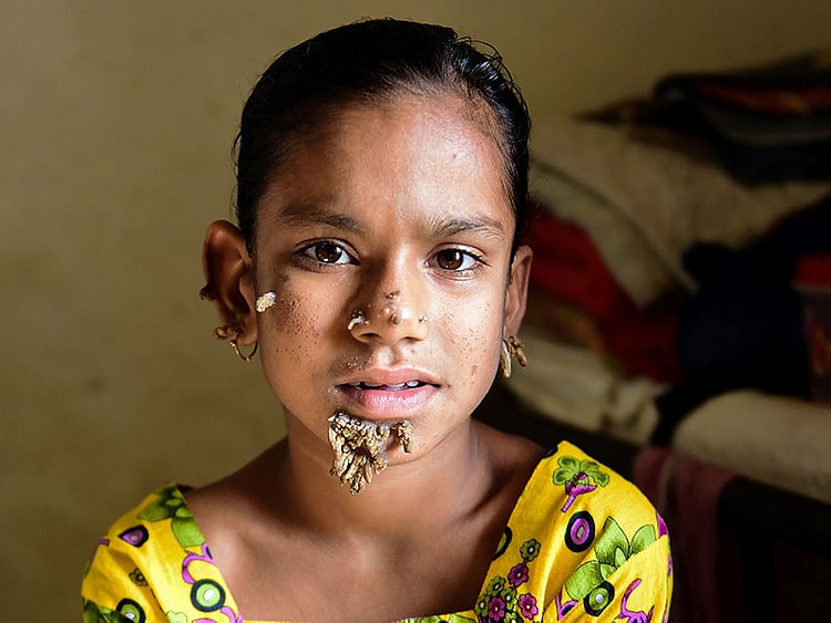 1.1971233-1504096642