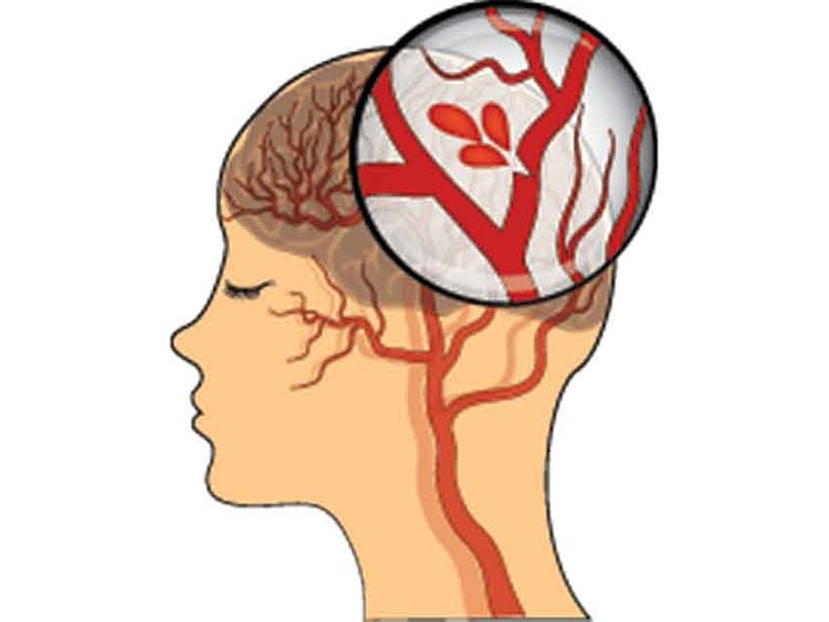 1.2115632-2241249942