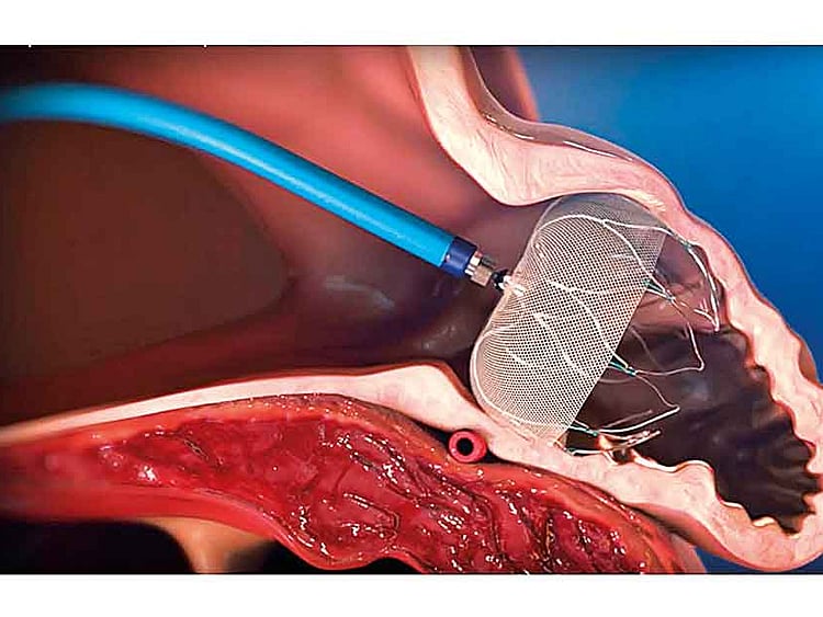 1.2115689-3810608666