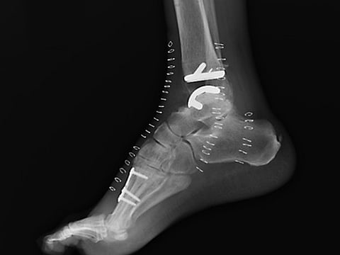 Courtesy of Duke Health