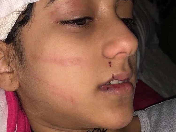 1.2125454-3087689370