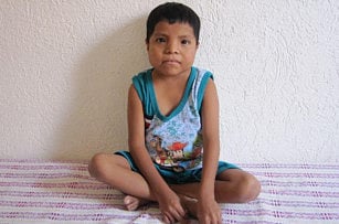 Birth defects tell story of toxic water