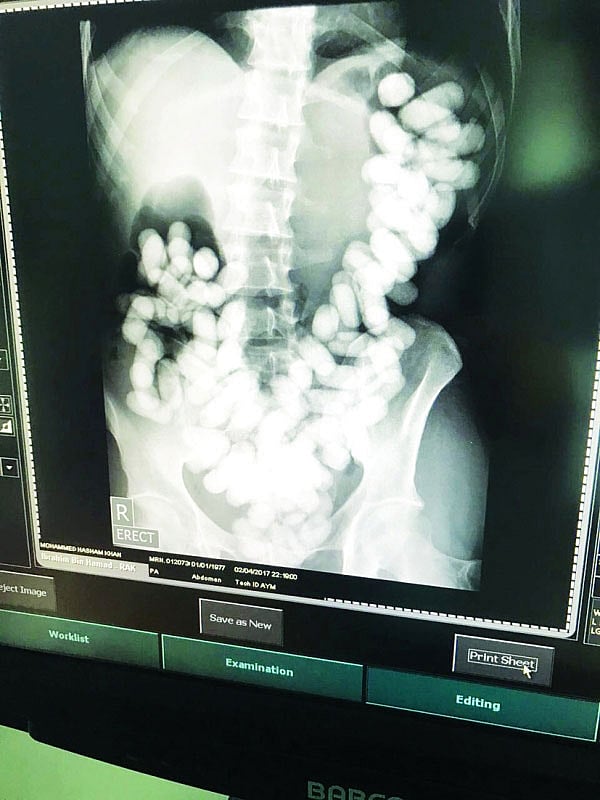 1.2008644-4163437810