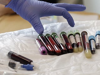 Killer T-cells: How they protect you from COVID-19