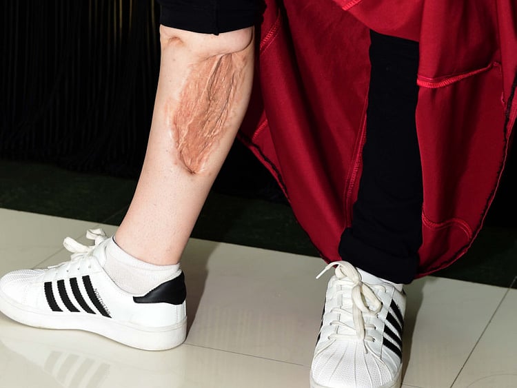 1.2043538-1996230686