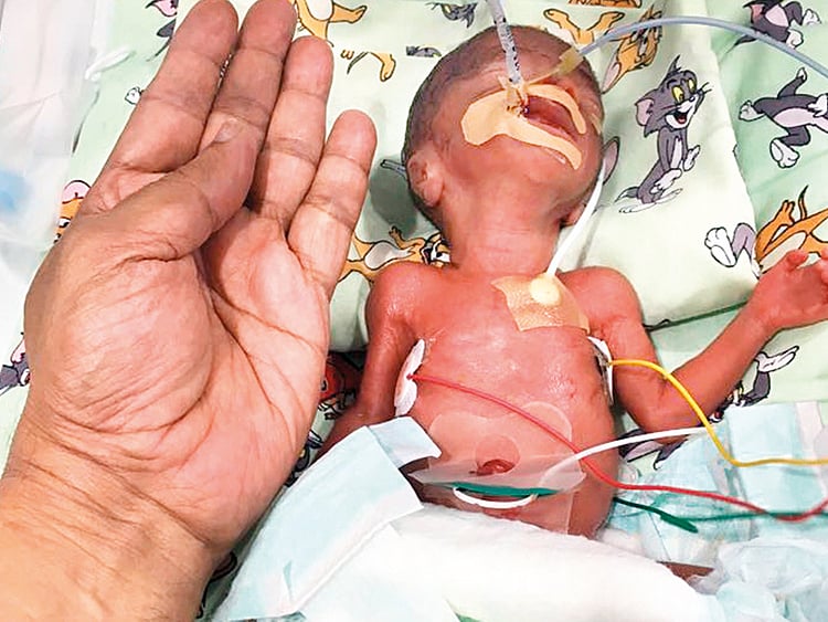 1.2053488-3596353506