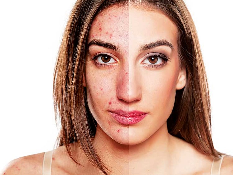 1.2151486-1167237398