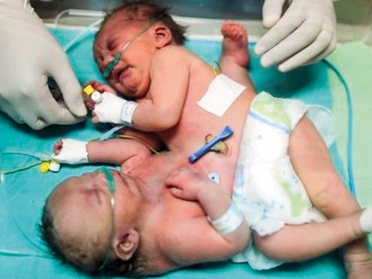 1.2153843-2554929402