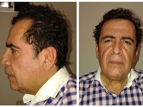 This two-image composite file photo released on Oct. 1, 2014 by Mexico's Attorney General's Office (PGR), shows alleged cartel capo Hector Beltran Leyva after his arrest by Mexican law enforcement authorities.