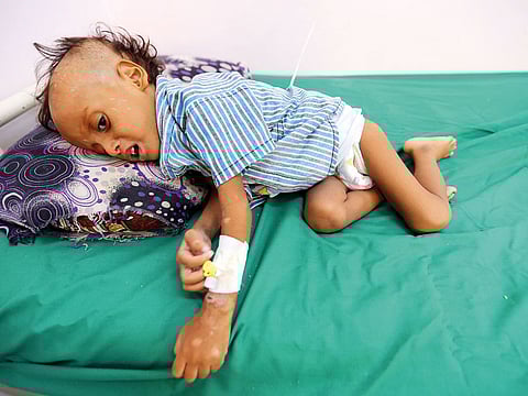 Two-year-old Jibril Mohammad Ali Al Hakami receives treatment for malnutrition in Hodeida. The government accuses Al Houthis of hijacking critical aid intended for civilians.
