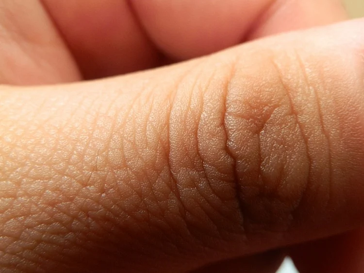 Skin