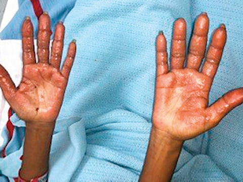 Courtesy: Rashid Hospital