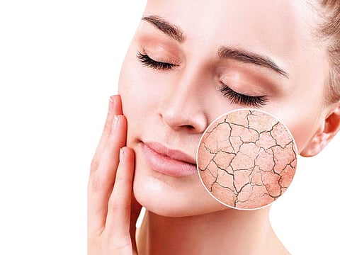 Psoriasis causes raised, red, and scaly patches to appear on the skin
