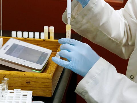 Inside America’s largest stockpile of exotic milks