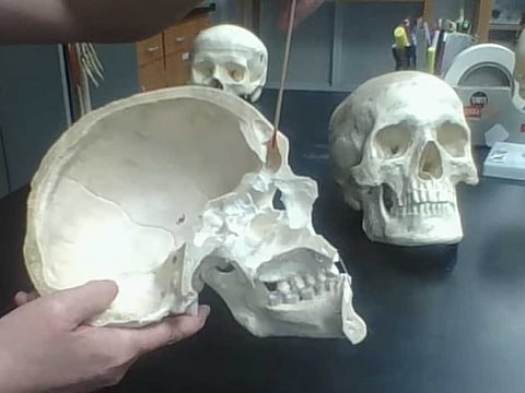 $800 purchase of a human skull reported as one of the wacky business expenses in the US.