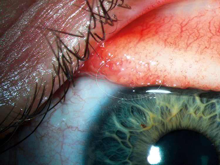 1.2172965-1628221781