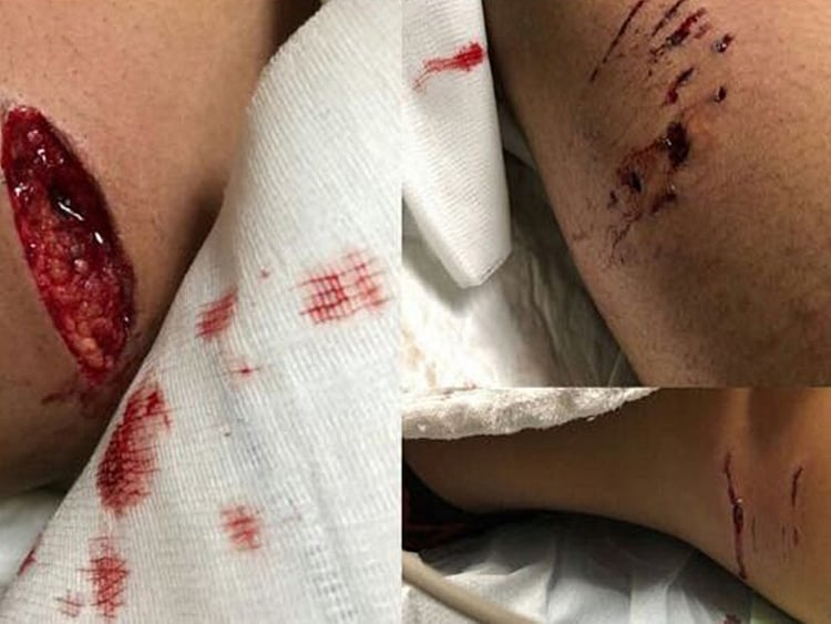 1.2193425-3378625196