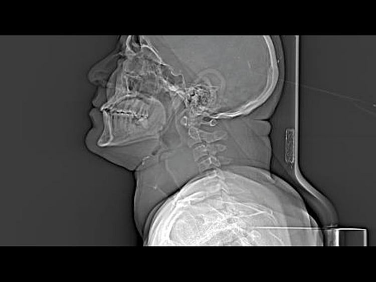 1.2205715-3846162876