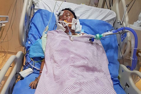 Dubai woman saved from deadly skin disorder