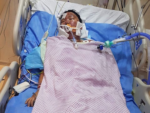 Dubai woman saved from deadly skin disorder