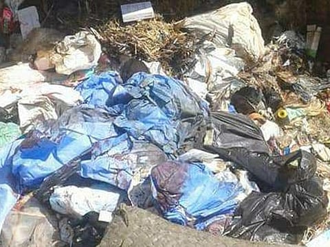 Egypt street cleaners find human organs in garbage bin