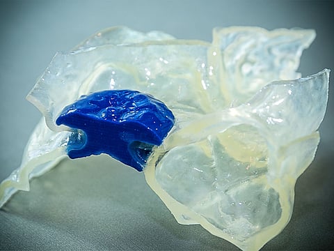 Surgeons at Cleveland Clinic Abu Dhabi use 3D printing to create highly accurate models to prepare for complex surgeries