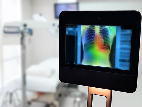 Algorithms have been designed to help detect pneumothorax, or collapsed lungs, in chest X-rays with high accuracy