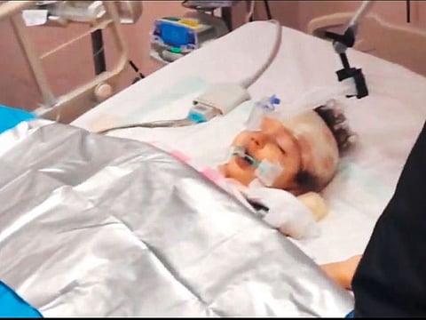 A 19-month-old girl has miraculously survived a fall from the 10th floor of a building in Ras Al Khaimah. She is fighting for her life at the ICU of Saqr hospital. L.M., an Egyptian girl, fell from the window of her 10th floor apartment in Ras Al Khaimah on Sunday night.