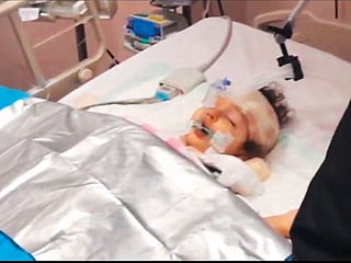 Doctors perform surgery on girl who fell from 10th floor