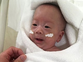 World's smallest baby boy weighing 268 grams sent home healthy
