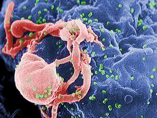 First person: Why a possible HIV cure is not cause for celebration