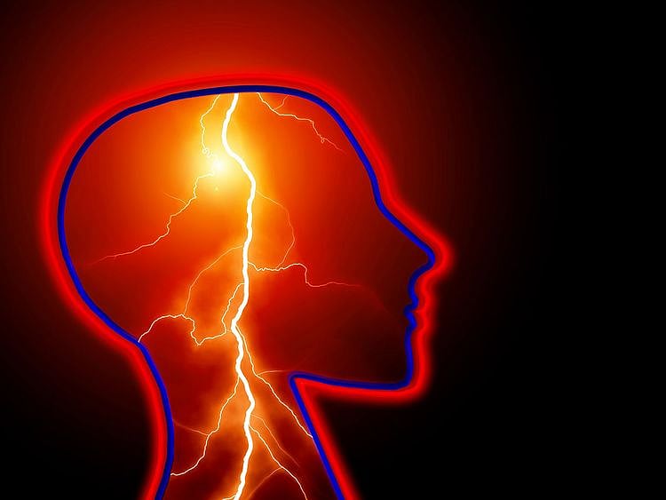 Epilepsy