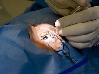 Cataract surgery -- a simple, 15-minute procedure -- is one of the most cost-effective medical procedures, providing immediate and lasting restoration of sight, the WHO said.

