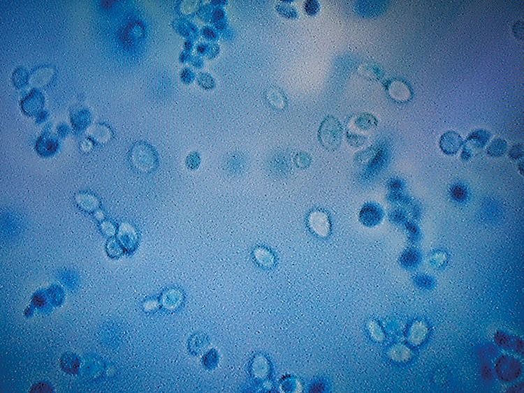 A projection of the C. auris fungus