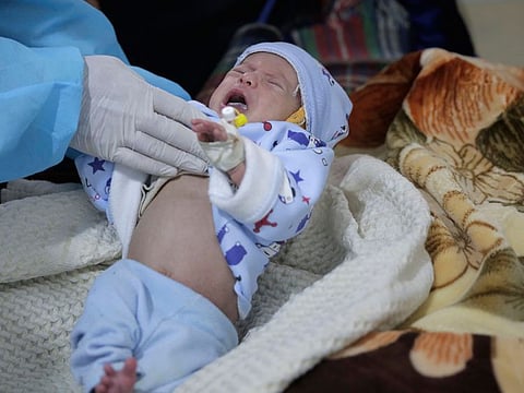 Doctor checks two-month-old Mujahed Ali, suffering from cholera infection, at Al Sabeen hospital, in Sanaa