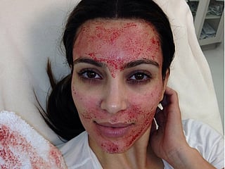 The Beauty Beat: Dr Barbara Sturm on her vampire facial