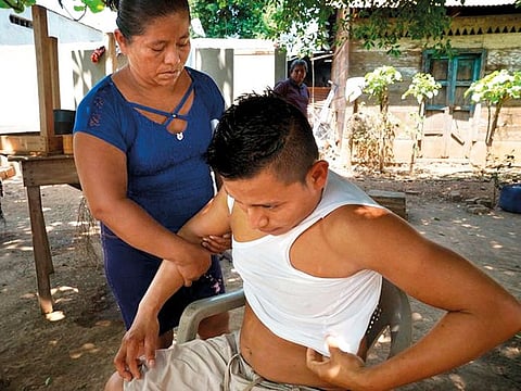 In Nica, Hermelinda Chavez Hernandez treats the injuries her son Carlos, 24, suffered in the truck accident a week earlier in Mexico