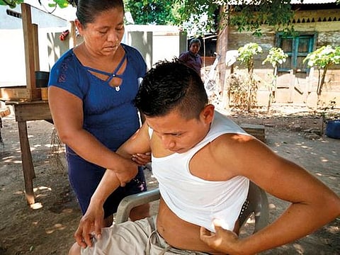 In Nica, Hermelinda Chavez Hernandez treats the injuries her son Carlos, 24, suffered in the truck accident a week earlier in Mexico
