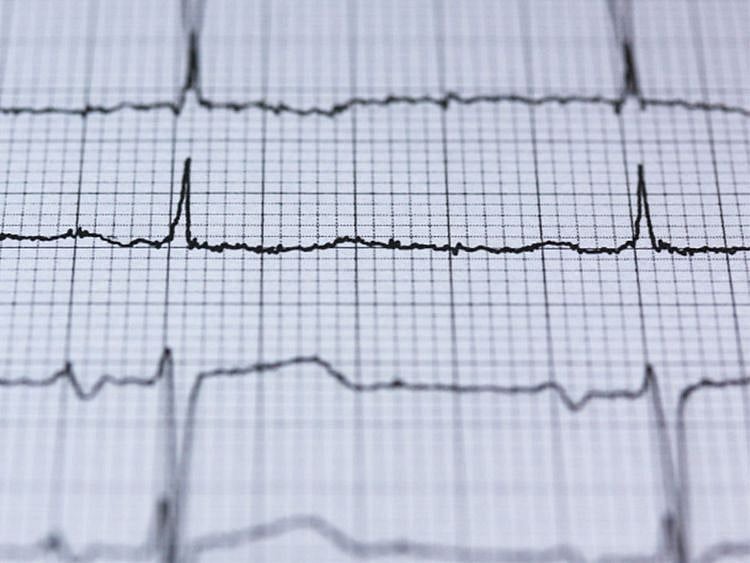 Heart operation 