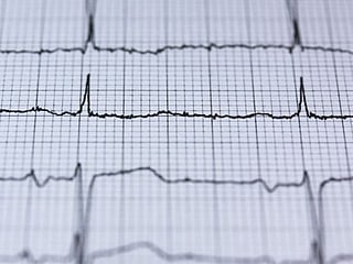 Exercise helps heart failure patients: Study