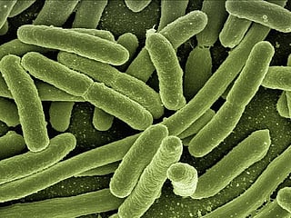 Gut bacteria may increase bowel cancer risk: Study